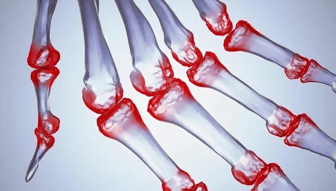 Dolor en las articulaciones de los dedos