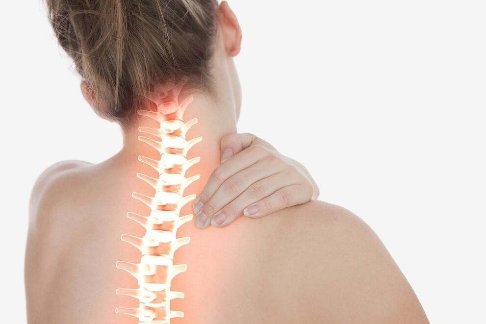 Osteocondrosis cervical y su tratamiento con ejercicios.